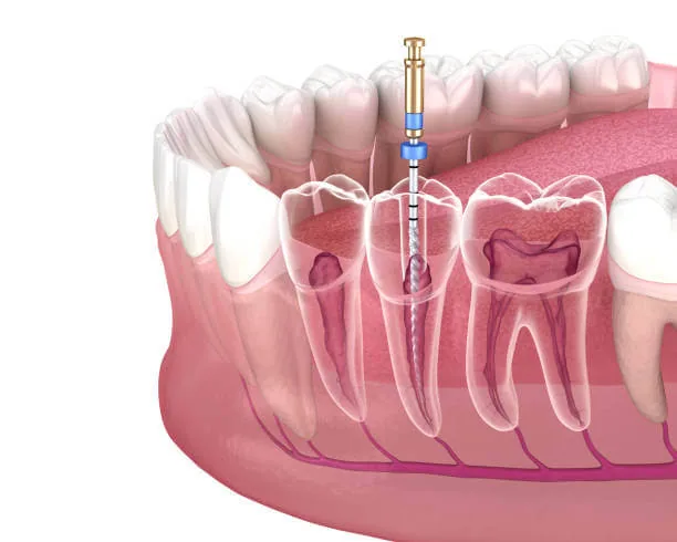 علاج جراحة الفم والخلع في مركز ابو المكارم لطب الاسنان