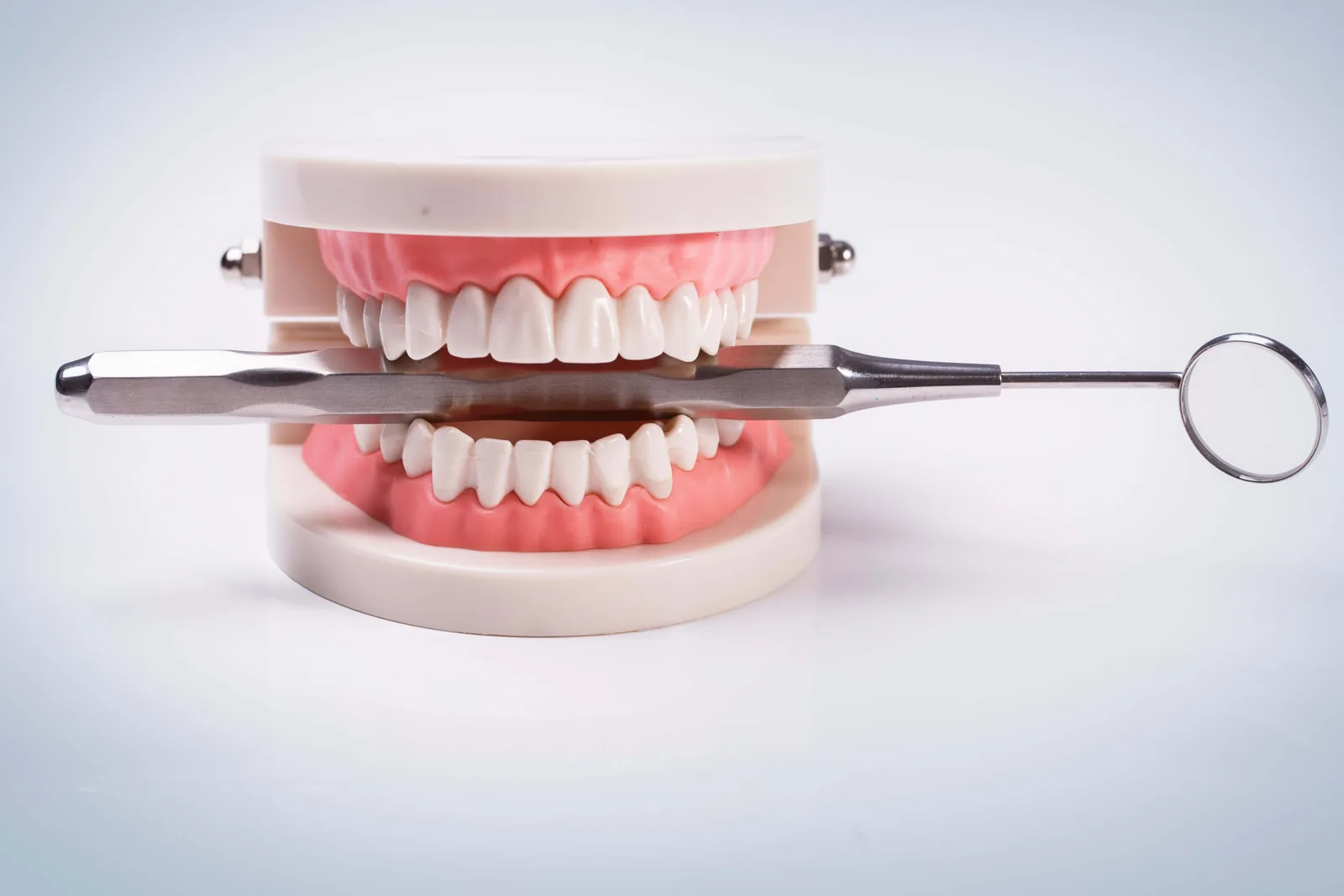 Dental model used to explain treatments